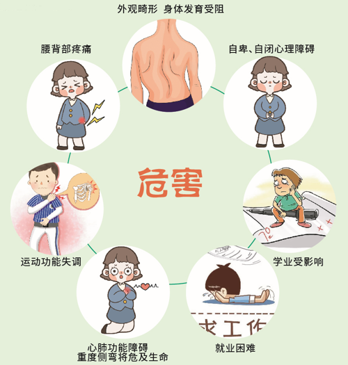 脊柱側彎危害