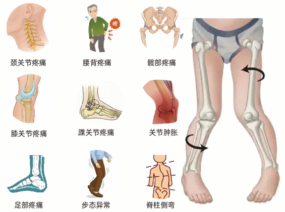 o型腿危害